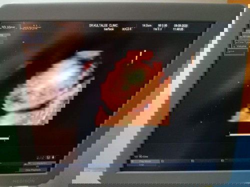 กลัว น้ำหนักลูกไม่ขึ้น