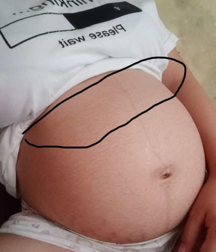 FTM