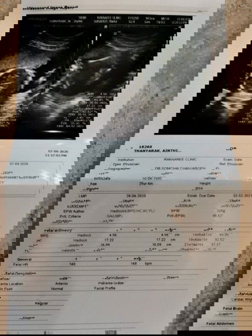 ได้ลูกชาย​ สมใจปู่กับย่า