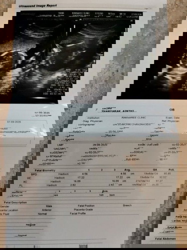 ได้ลูกชาย สมใจปู่กับย่า