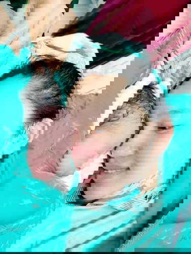 ทีมกันยาผ่าคลอด38+3