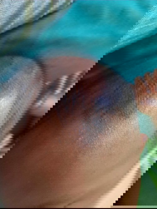 Biang keringat adan ketombe atau apa ya??