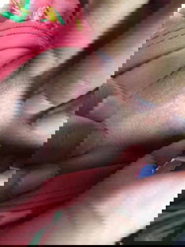 เป็นแบบนี้ผิวจะหายเป็นปกติไหม