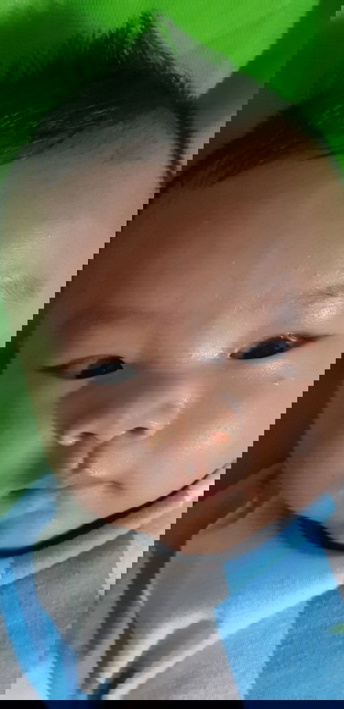 Bé bị nỗi mẫn