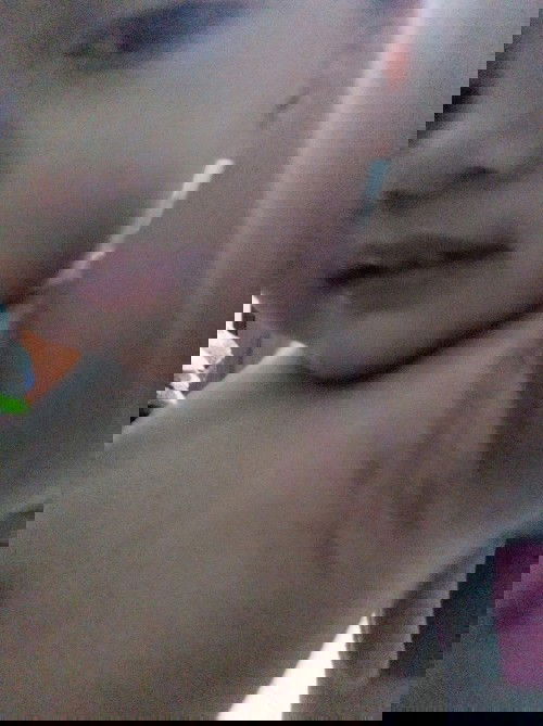 Ruam merah di ketiak