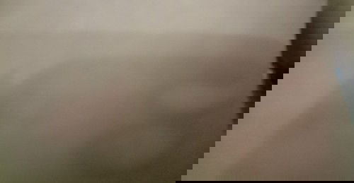 Tentang jamur di kulit bayi