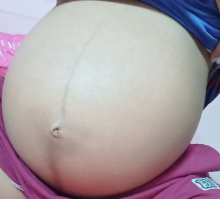 33Week