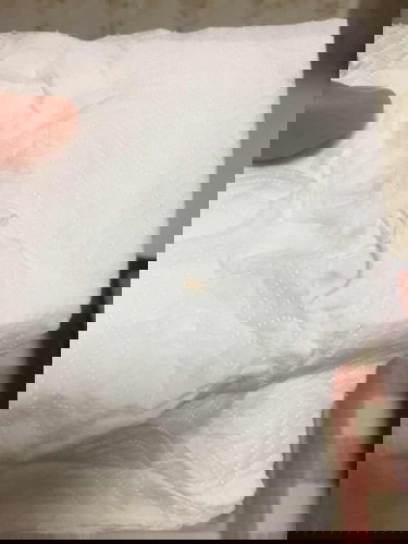 ตั้งครรภ์ 36 สัปดาห์ 4 วัน