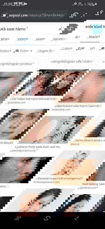 Tak Mau Kulit Kusam saat Hamil