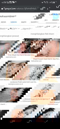 Tak Mau Kulit Kusam saat Hamil