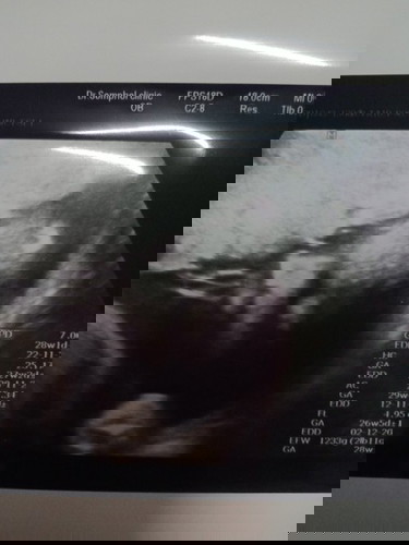 ตกลงยังไงค่ะใครรุบ้างมั้ยค่ะ