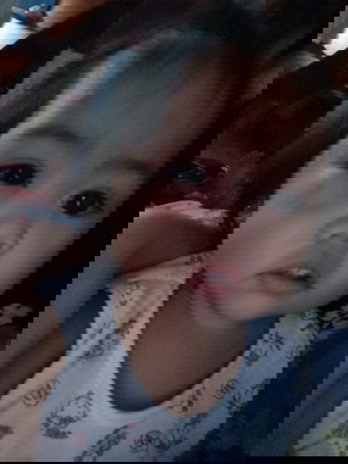 Namamaga na mata ni bb