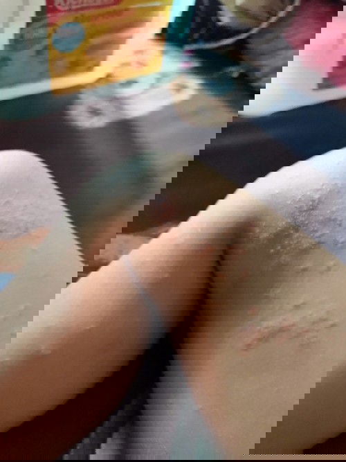 Sp anak atau sp kulit ??