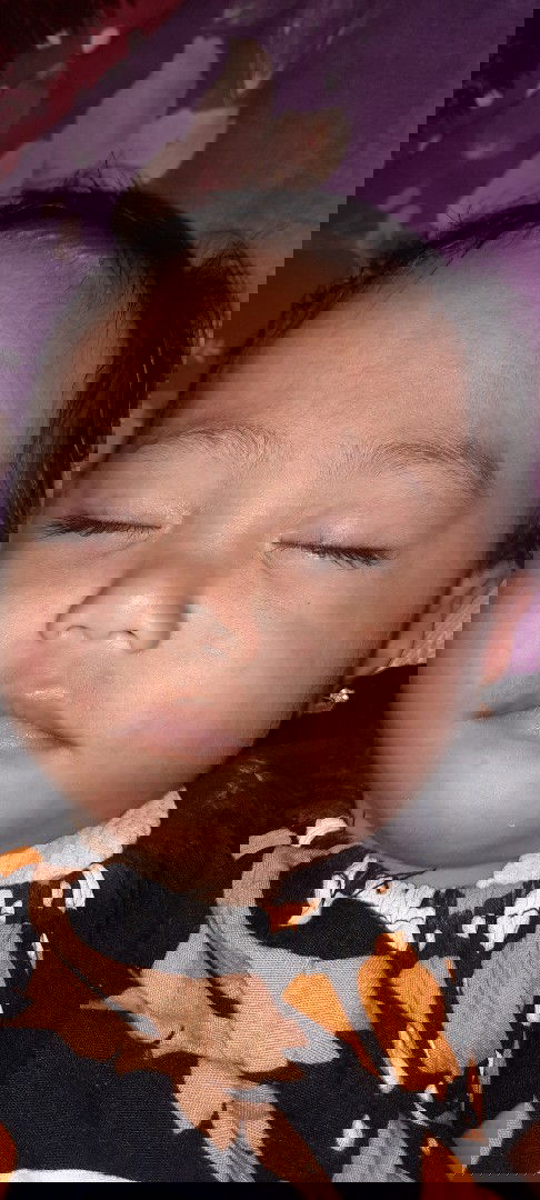 WAJAH BAYIKU 10 BULAN MEMERAH