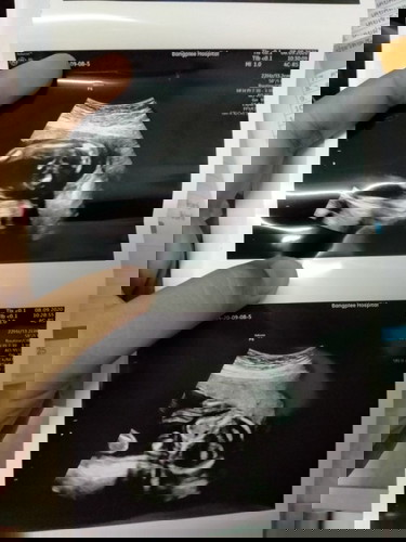 หมอบอกว่าชายจ้า