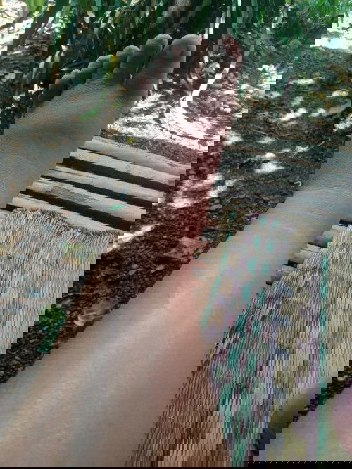 เ ท้าบวมจะเป็นไรไหม