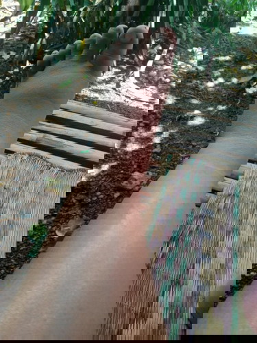 เ ท้าบวมจะเป็นไรไหม