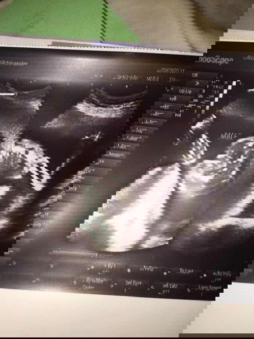 ช่วยดูไห้หน่อยค่ะเป็นลูกชายหรือลูกสาว