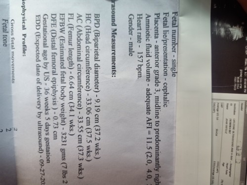 normal lang po ba yung FL ng ultrasound ni baby ko?