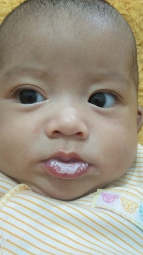 Jamur Lidah