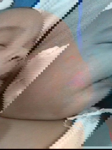 WHITE PATCHES