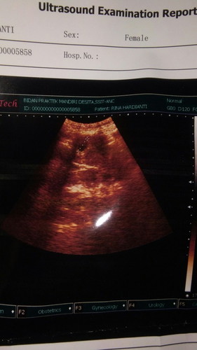 Kehamilan 6week