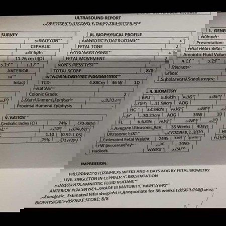 BPS result