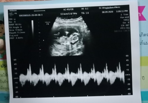 14W 2D