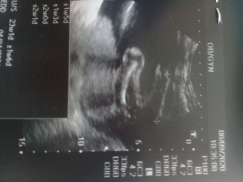 เเม่ๆดูกันออกไหมค่ะ ว่าน้องเพศอะไร 😂😍