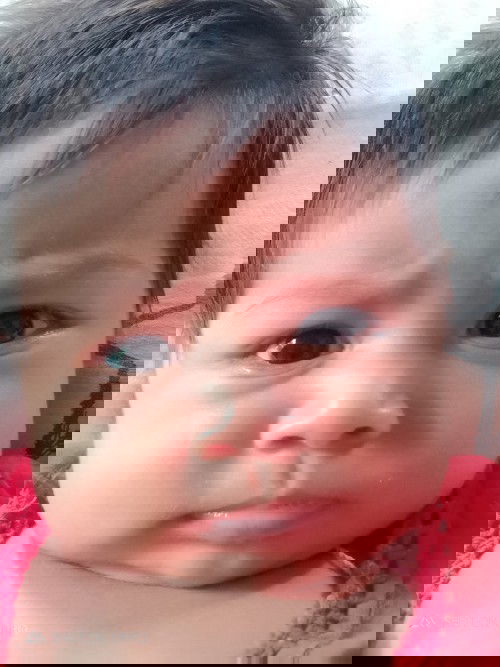 เด็กแหวะนมบ่อย น้องโฟร์เกรซ 2เดือน 20วัน