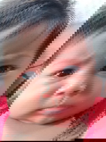 เด็กแหวะนมบ่อย น้องโฟร์เกรซ 2เดือน 20วัน