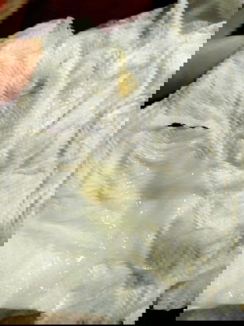 มีมูกขาวแบบนี้ออกทั้งวัน เช็ดได้ทุกครั้งที่เข้าห้องน้ำจะคลอดหรือป่าวคะ