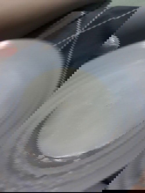 Sữa mẹ nổi váng