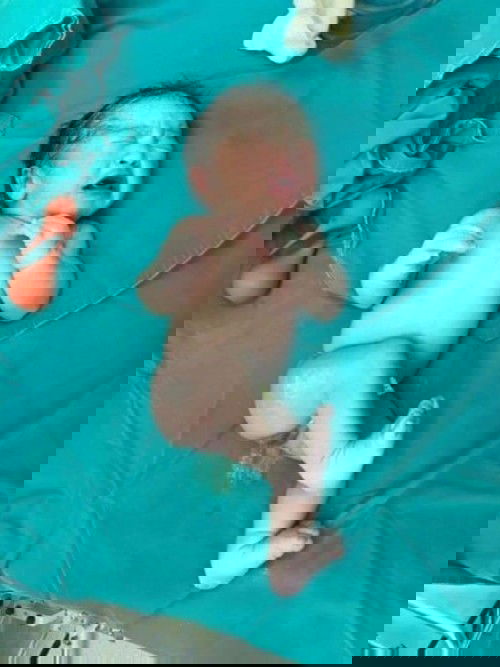 เล่าประสบการณ์ผ่าคลอด&คลอดเอง