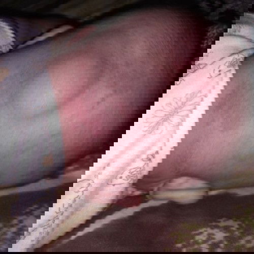 Benjolan lembek dibelakang kepala