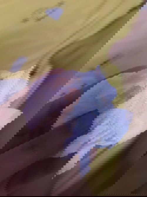 มีเลือดออกเเต่ไม่ปวดท้องค่ะ