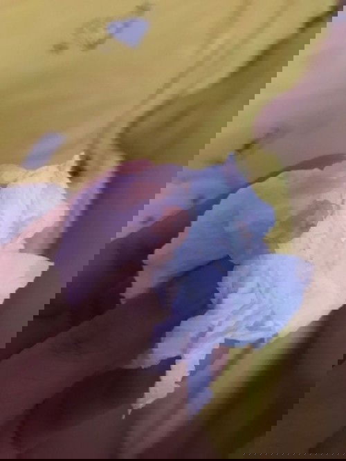 ประจำเดือนขาดหาไปสองอาทิตย์