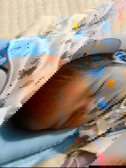 ผดผื่นขึ้นหน้าลูก