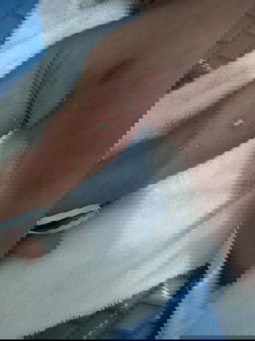 Bintik bintik d ketiak