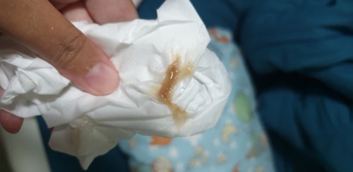 สอบถามค่ะ มีมูก