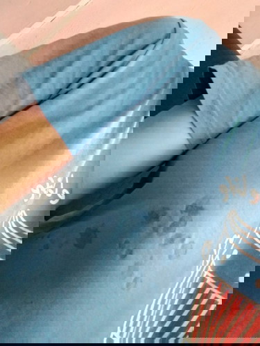 Breast Leakage