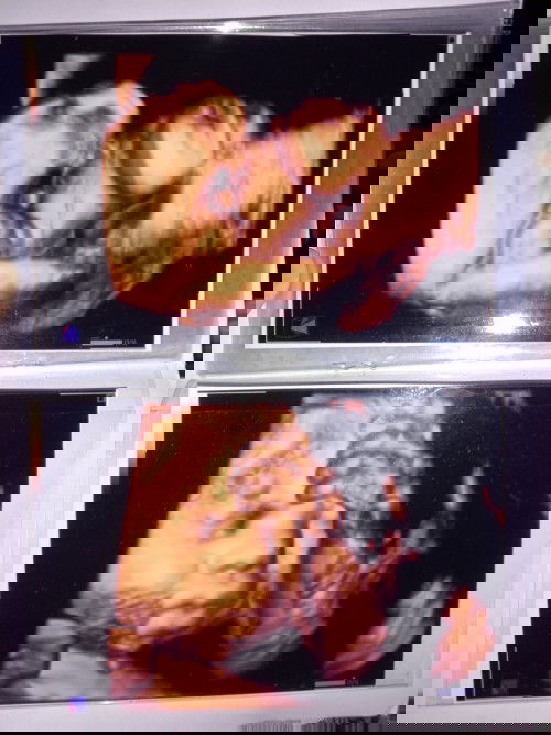 Bru pertma liat si de"k