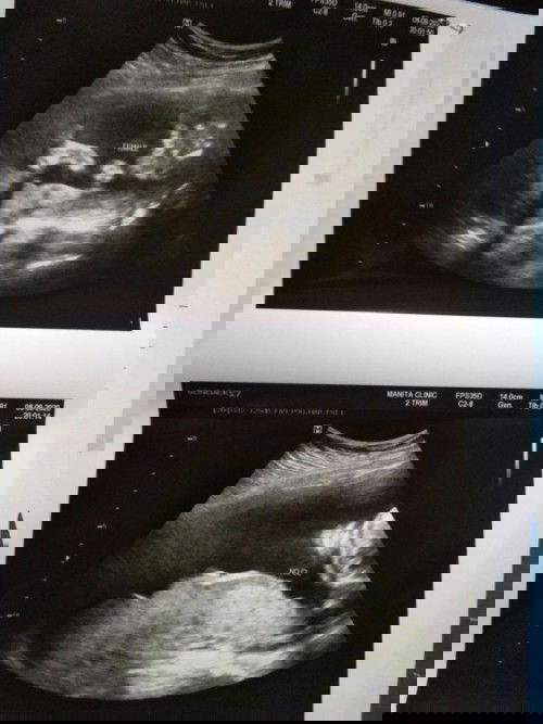 แม่ๆคนไหนมองออกช่วยดูไห้หน่อยนะค้ะว่าผู้หญิงรึผู้ชาย