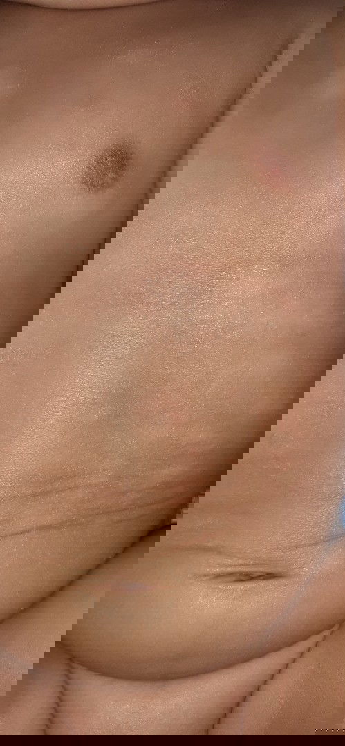 Bercak putih ditubuh bayi