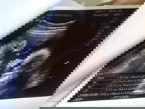 ตรงนี้คือส่วนไหนของน้องค่ะพยามดูแล้วดูไม่ออกจริงๆ