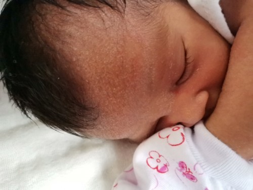 Hello po tanong ko lang po ako po kayang gamot sa Rashes ni baby naawa na po kasi ako π