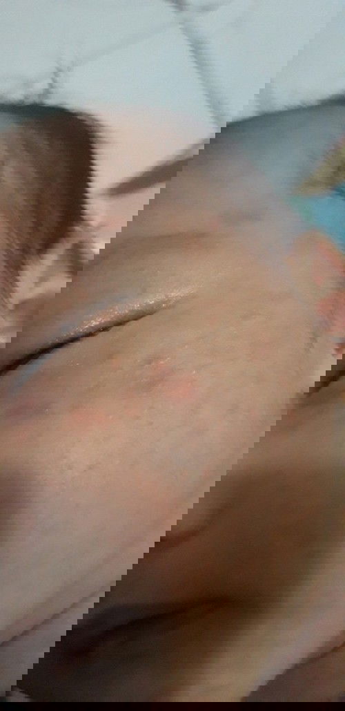 Krim biang keringat bayi?