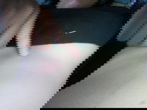 เจ็บจี๊ดๆ​ เหมือนเนื้อชีกใต้ราวนม