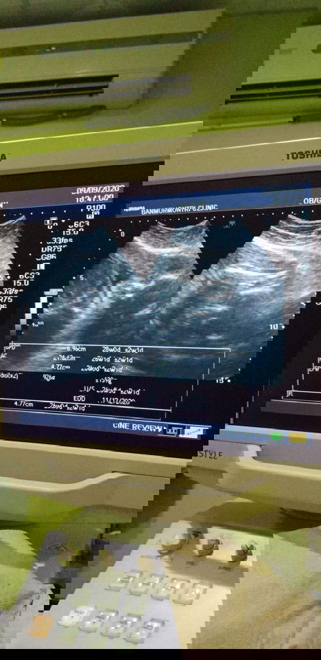 นน.ลูกน้อย💓