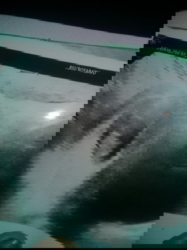 diusia kandungan 12 minggu saya mmgalami pndarahan dan kta dokter bayi saya dlm kndungan tidak berkembang..saya terpaksa harus dikuret dan itu rsa ny sedih banget,,apakh ad diantara bunda2 dsni yg mngalami seperti saya..๐ญ๐ญ